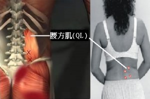圖3. 腰方肌(QL)